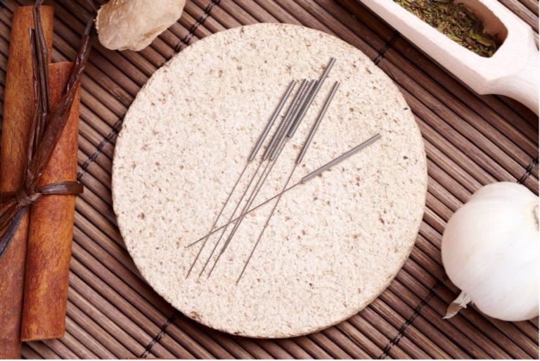 Das Bild zeigt Akupunktur-Nadeln, die für eine Behandlung bereitliegen - Katja Klein ist Ihre Spezialistin für Traditionelle Chinesische Medizin & Akupunktur im Saarland - in Merchweiler bei Illingen